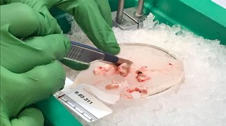 Cutting up live human brain tissue