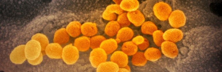 microscope image of coronavirus