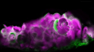 hydroxyapatite and amelotin deposits