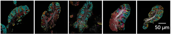 tongue surface cells with highlighted bacteria