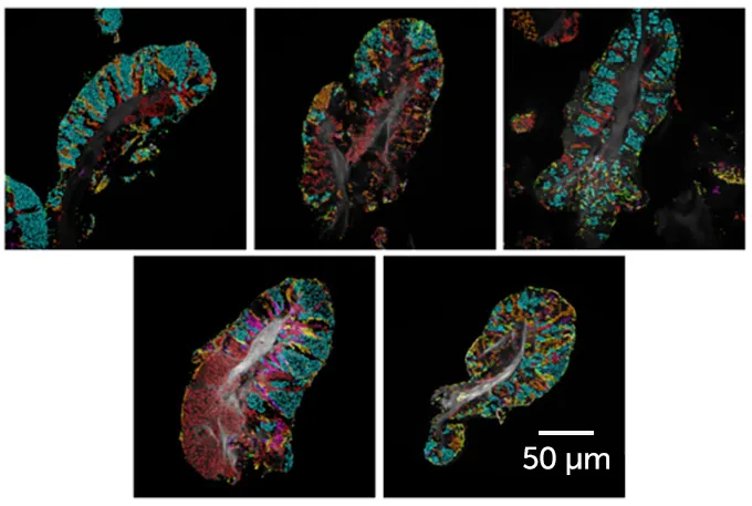 tongue surface cell examples with highlighted bacteria