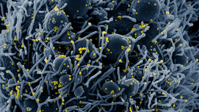 SARS-CoV-2 infecting a cell