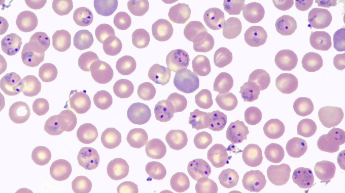 Malaria parasites