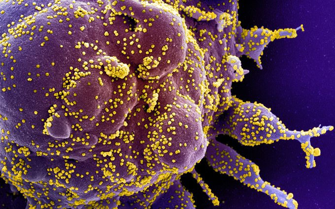 SARS-CoV-2 SEM image