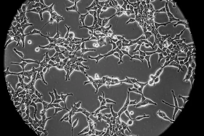 microscope image of HEK-293 cells