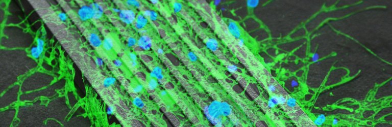 nerve cells and a tiny robot