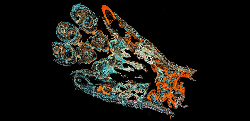 mouse paw infected with Chikungunya virus