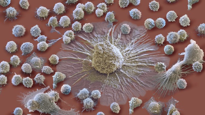 macrophage and leukocytes