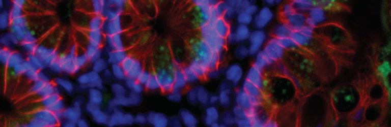 the coronavirus SARS-CoV-2 in intestinal cells