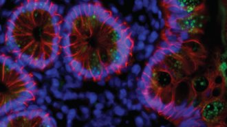 the coronavirus SARS-CoV-2 in intestinal cells