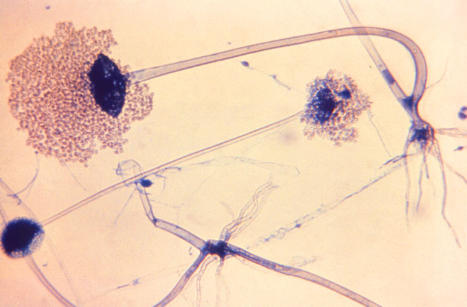 microscope images of Rhizopus arrhizus spores