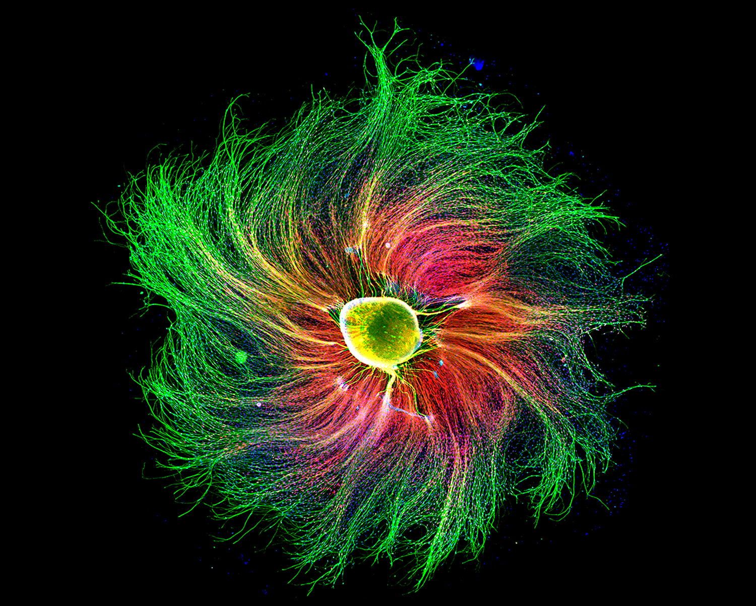 cluster of nerve cells from a rat embryo. The major structural component of the cells, the outside of the whirl, is green. The supporting structure is red. The nuclei are blue.