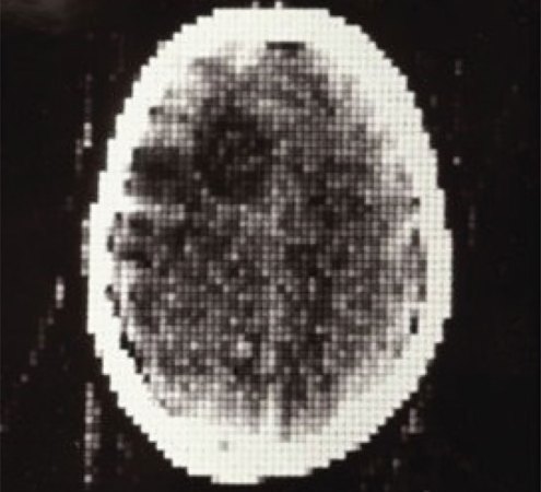 first CT image of a patient showing the brain area