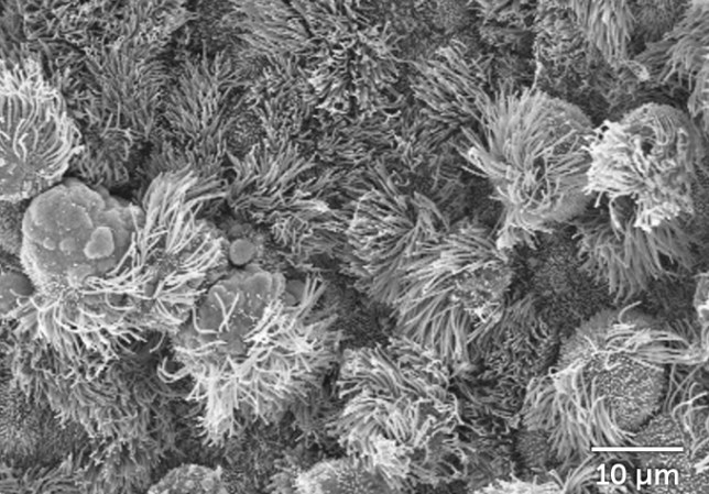 Microscope images of untreated airway cells