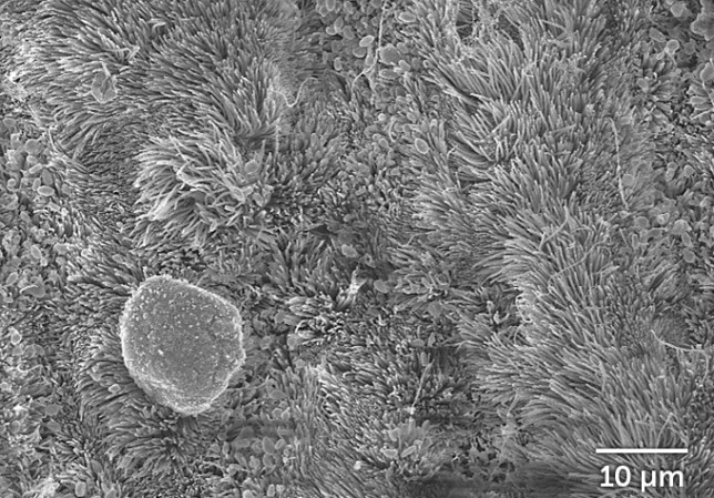 Airway cells treated with the immune system protein interleukin-13, 96 hours after a coronavirus infection
