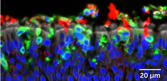 microscope image of human airway cells infected with SARS-CoV-2, showing depleted mucus stores