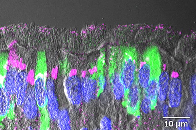 side view of human airway cells with keratan sulfate and visible SARS-CoV-2 infections