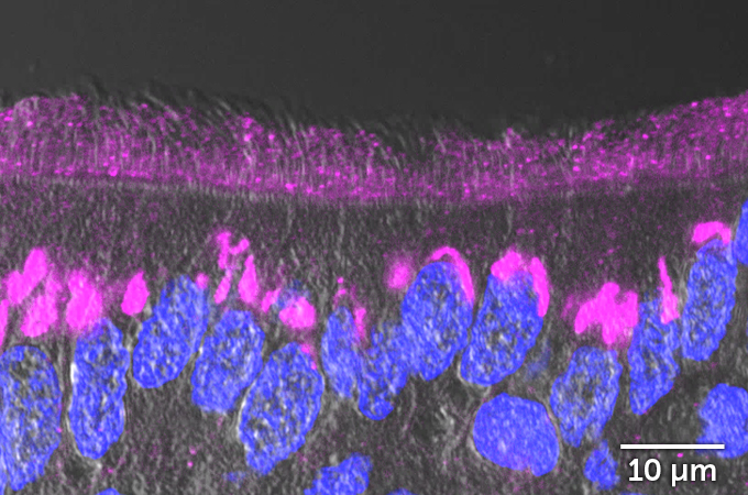 human airway cells treated with IL-13, showing almost no coronavirus infections and a thick layer of keratan sulfate