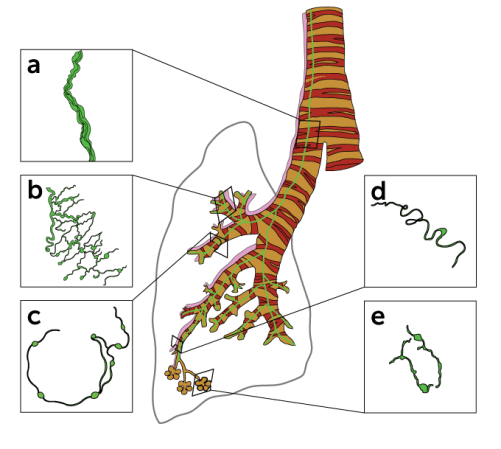 Where some glia are found in a mouse lung