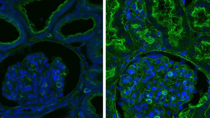 side-by-side microscope images of pigs’ kidneys with actin highlighted in green