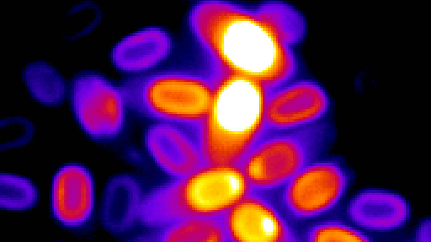 くまろくsuper dwarf bacteria spore くまろくsuper dwarf bacteria spore くまろくsuper dwarf bacteria