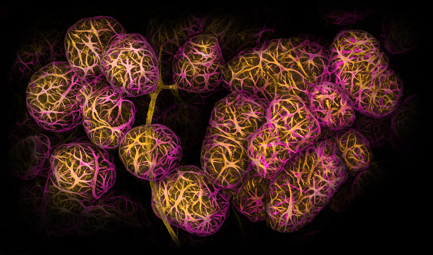 ball-like structures colored magenta and yellow clustered around a blood vessel, colored yellow, against a black backdrop