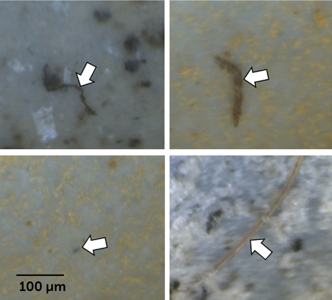 Four microscope images showing microplastic particles found in human lung tissue.
