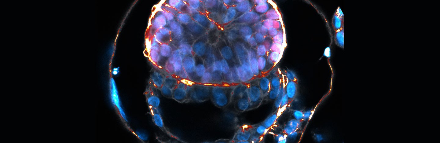 A model of a human embryo against a black backdrop. The model has ane exterior ring dotted with bluish light clumps. Wtihin is an oval-shaped purplish blob of cells with orange running through it. Below that are long bluish structures, also with bright orange and white running between cells