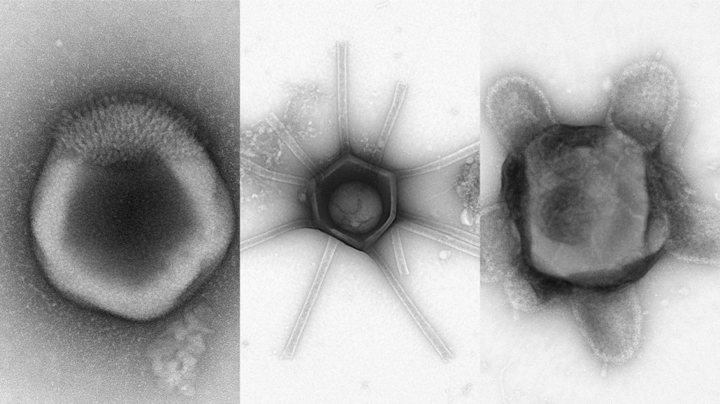 A collection of three microscopic images of potential giant viruses.