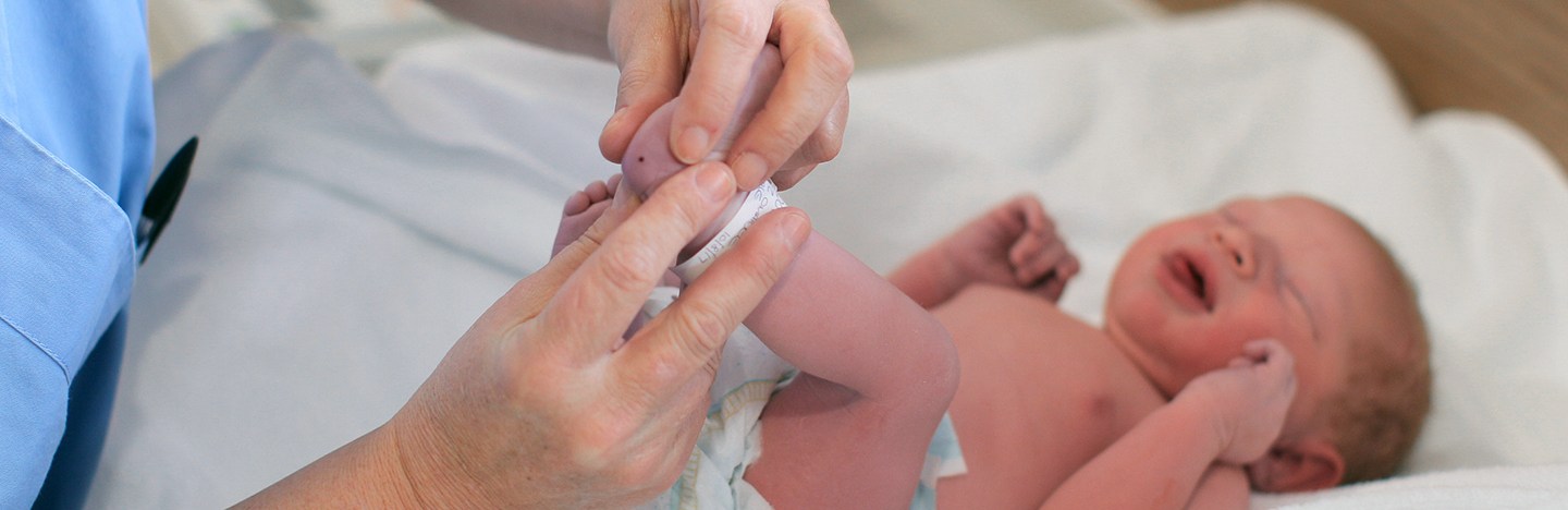 A pediatrician administers a heel prick test to check sucrose levels in a newborn baby boy after a caesarean section.