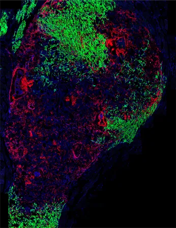 An image of a mouse vertebral bone, in red, mixed with a newly identified type of stem cell, in green, on a black background.