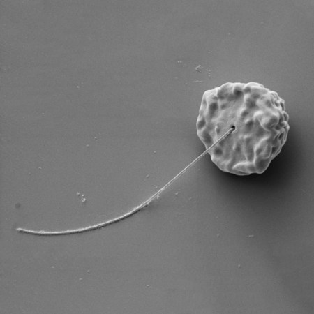 An image of protist Idionectes vortex.