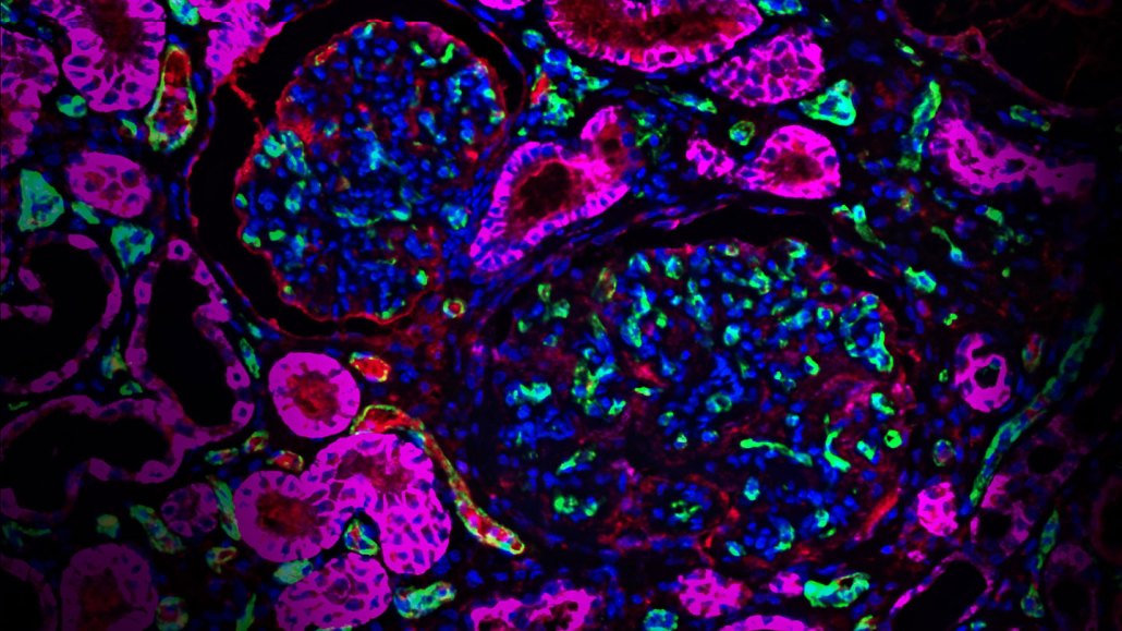 microscope image showing pig kidney tissue with human proteins in fuchsia