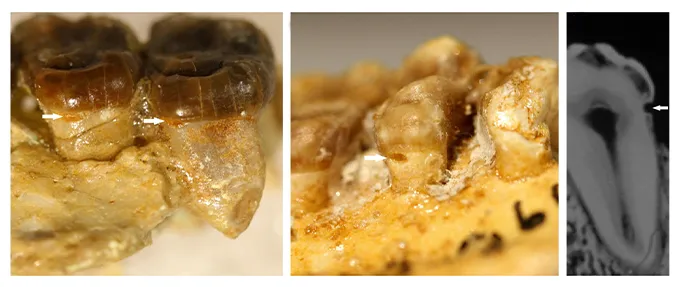 three separate images, including one x-ray, show cavities on fossilized primate teeth