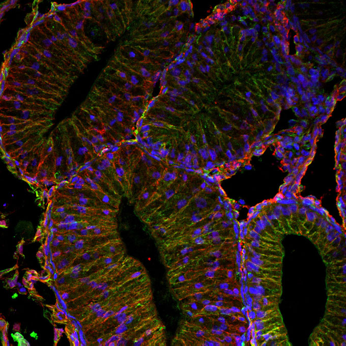 Green oval shapes with blue spots are seen against a black background in this microscopic cross-section of tadpole intestines.
