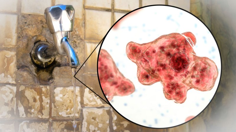 Don’t use unsterilized tap water to rinse your sinuses. It may carry ...