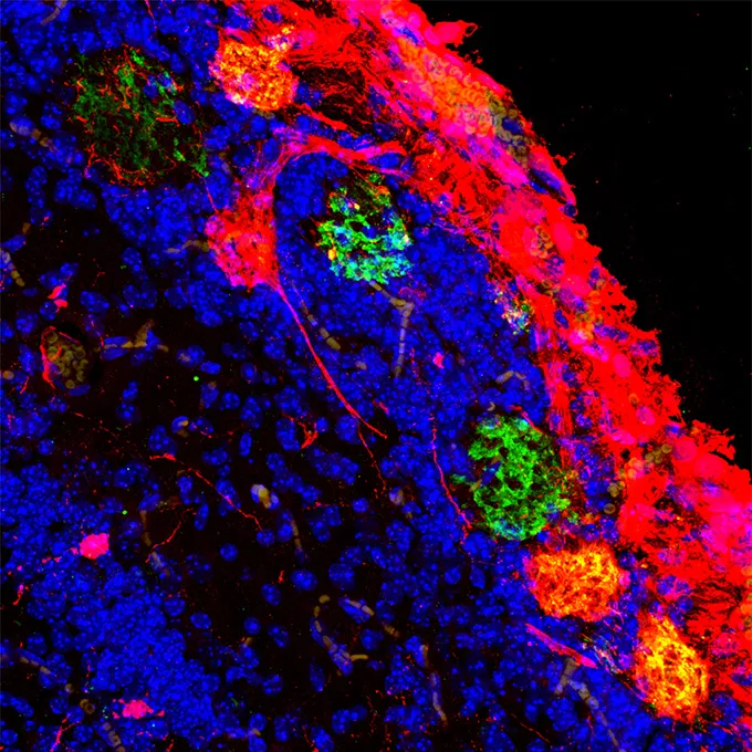 This colorful slice of a mouse brain shows where rat brain cells have taken hold in the animal's structures that detect smells. Structures that show up as red circles in the image were formed by the rat cells.