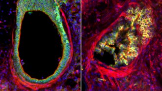 Two side-by-side images of a mouse's airway. In the one on the left, a ring of greenish tissue surrounds a black space, indicating the airway is open. On the right, that black area is filled with a chaotic mass of that tissue (now appearing greenish yellow), showing how the cells lining the area can clog the airway and make it harder to breathe.