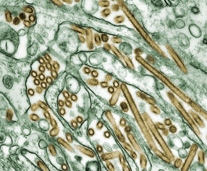 A microscopic image of H5N1 virus