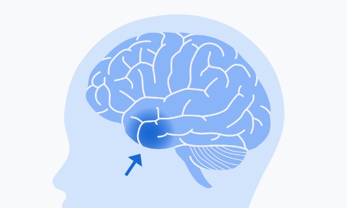This digital drawing of a person's head shows the brain inside. An arrow points to the bottom left side of the brain.
