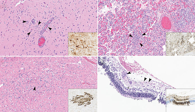 The image shows a grid of four squares, each a pinkish tissue sample from a different organ of a cat that was infected with bird flu. Small arrows point out where the virus damaged tissue in the brain (upper left), lungs (upper right), eye (lower right) and heart (lower left). Insets in each image show the virus, which appears dark brown, in each kind of tissue.