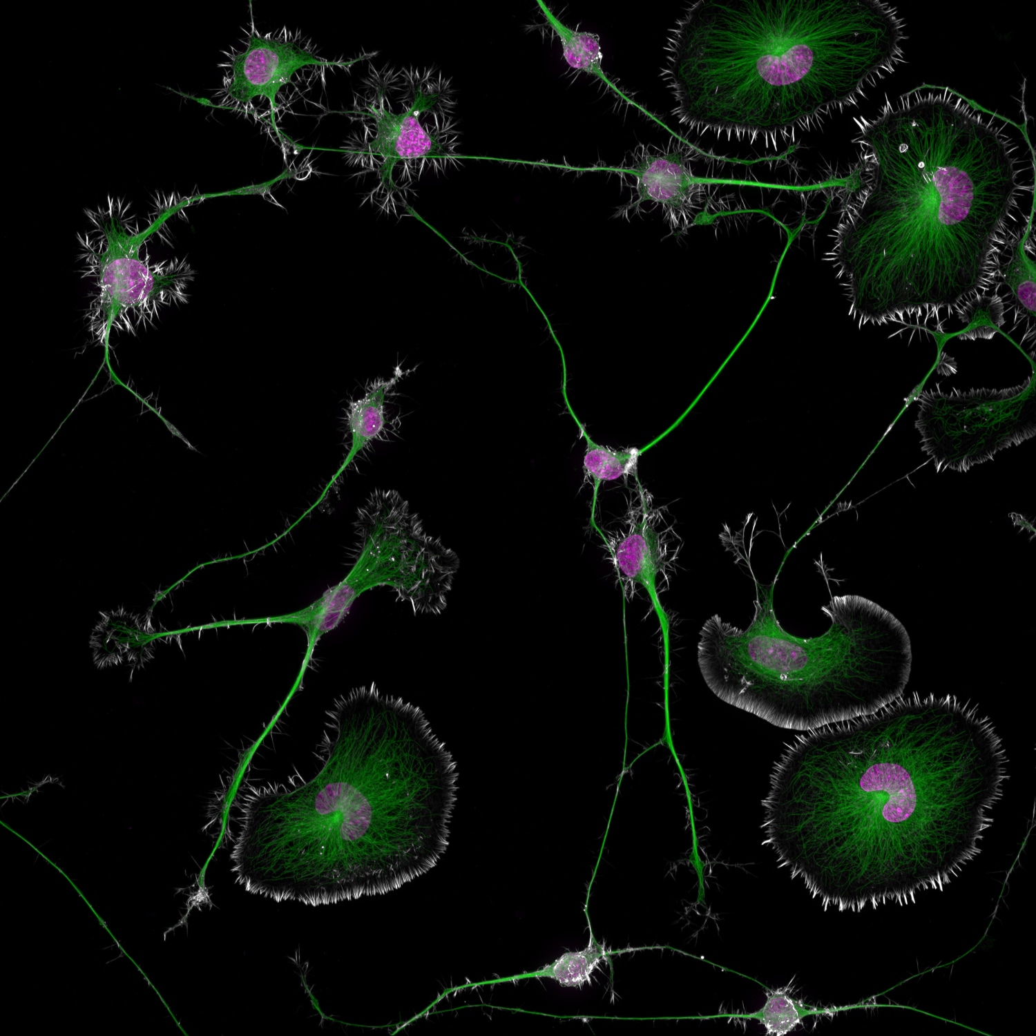 Green tendrils connect puffs of green and magenta of various sizes against a black background