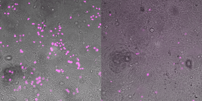 Two side by side gifs. On the left, a growing number of pink speckles indicate venom toxins are killing cells. On the right, fewer pink speckles indicate that designer proteins are protecting cells from toxins.
