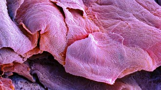 Dark pink skin cells that look like layers of rose petals are shown in a scanning electron micrograph at the site of a wound. Skin and other epithelial cells may send out pulses of electricity when wounded.
