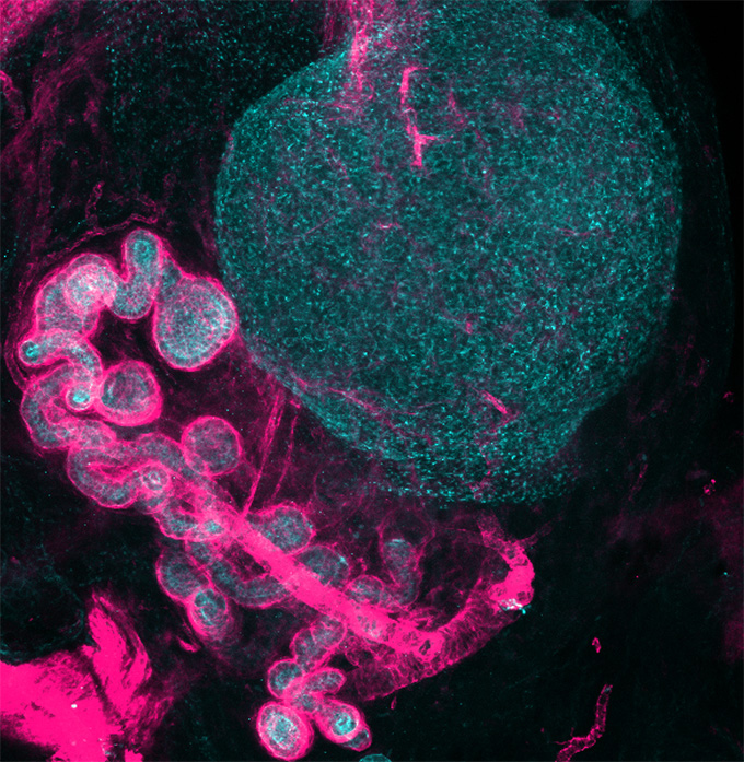 This image shows a round ovary in blue toward with a magenta-colored tubelike structure below it.