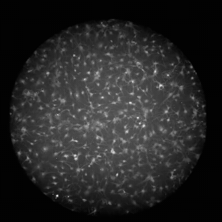 Astrocytes from rats pulse with light, which indicates their activity.