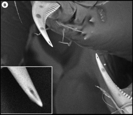 This black and white image shows a closeup of the fangs of a typical spider species. The inset zooms in on the tip to show the opening to a channel that allows venom to flow into whatever the spider bites.