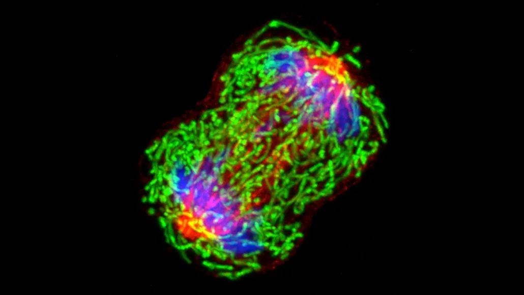 This microscopy image shows a breast cancer cell dividing into two. The components of the cell are shown in bright green, blue and red.