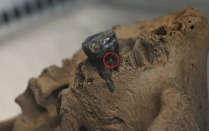 A closeup of an ancient jaw has a blackened tooth still embedded in it. A red circle on the side of the tooth shows where researchers took a sample for genetic testing.