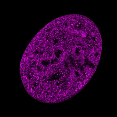 An uninfected cell, shown in purple, has its DNA spread throughout it, making it look mostly filled in. This is the first of four images in a slideshow.